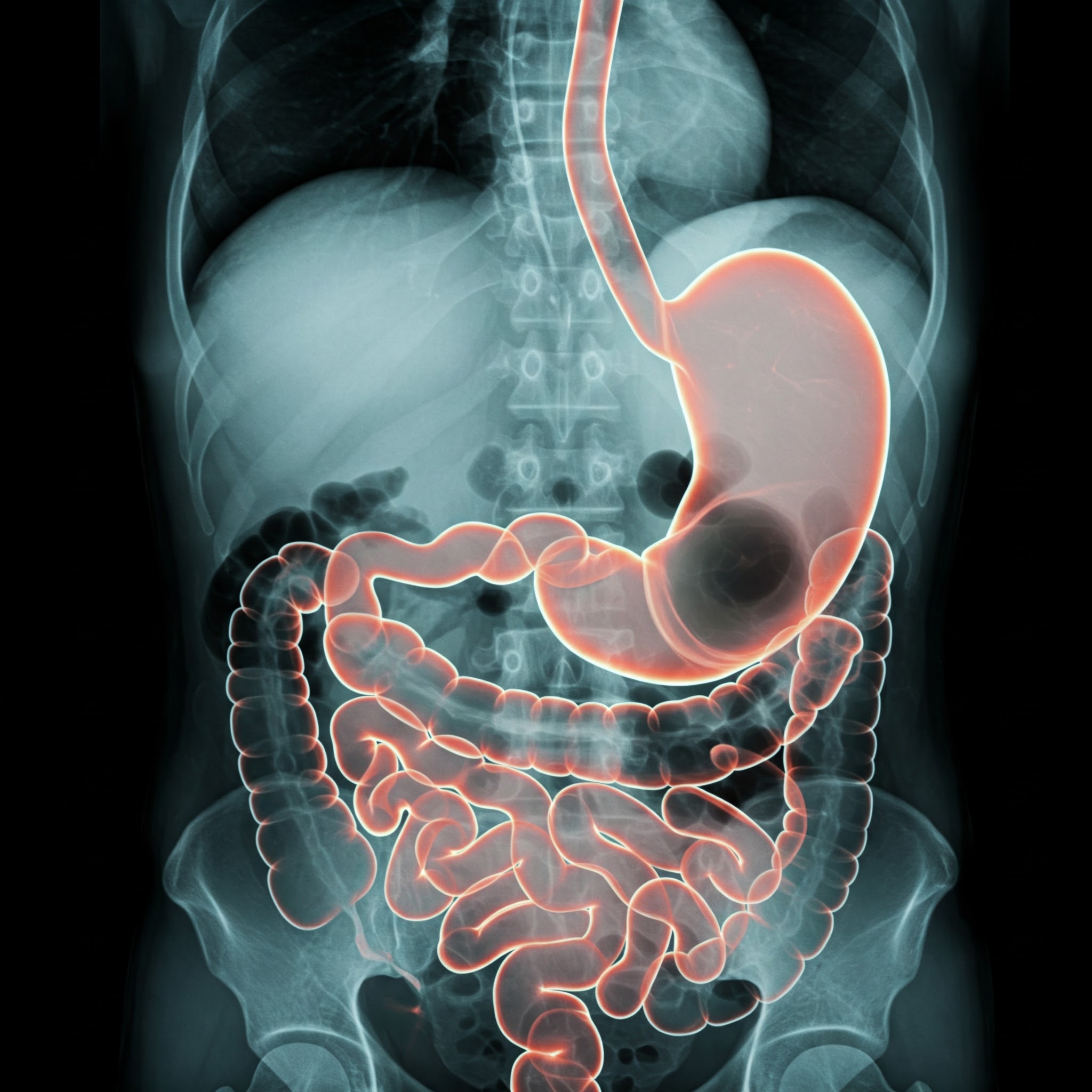 UPPER GI AND SMALL BOWEL SERIES